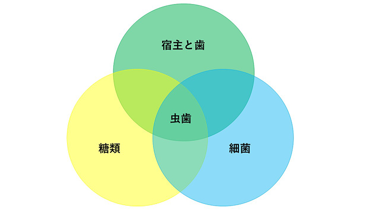 むし歯治療の前に-どうしてむし歯になるのか？